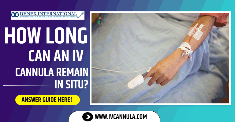 How Long Can an IV Cannula Remain in Situ