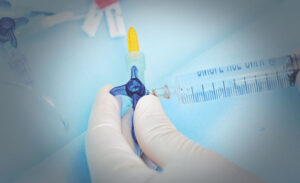 Injection Port in IV Cannula